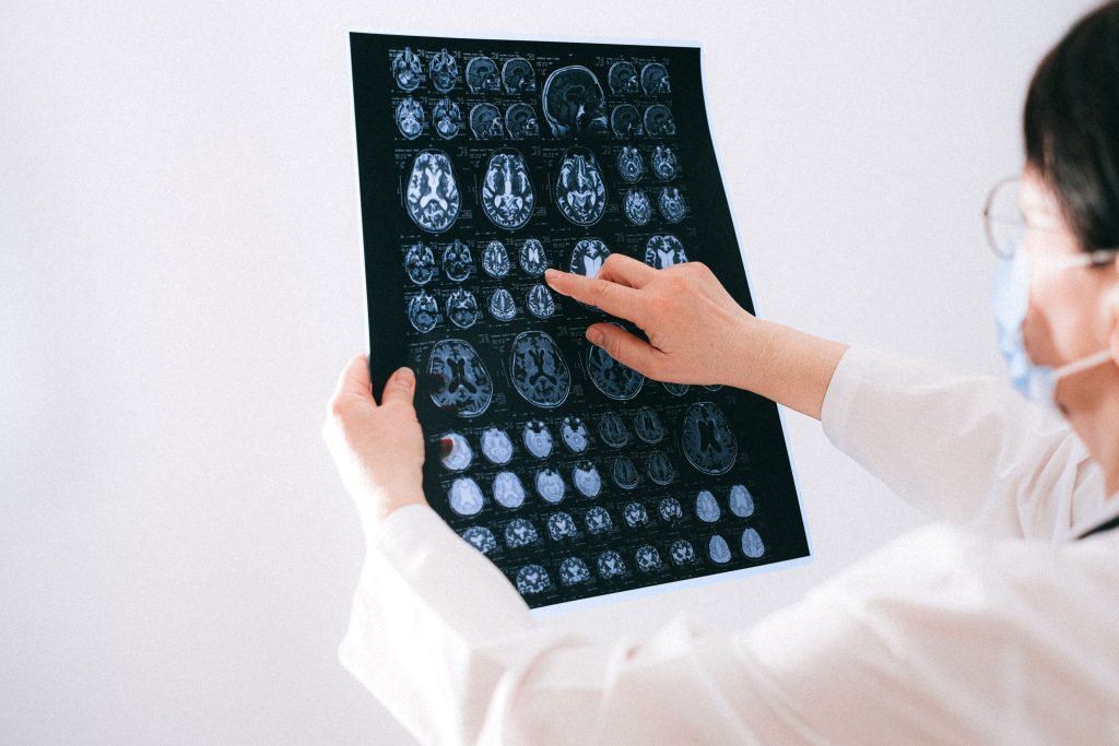 alzheimer’s diagnosis